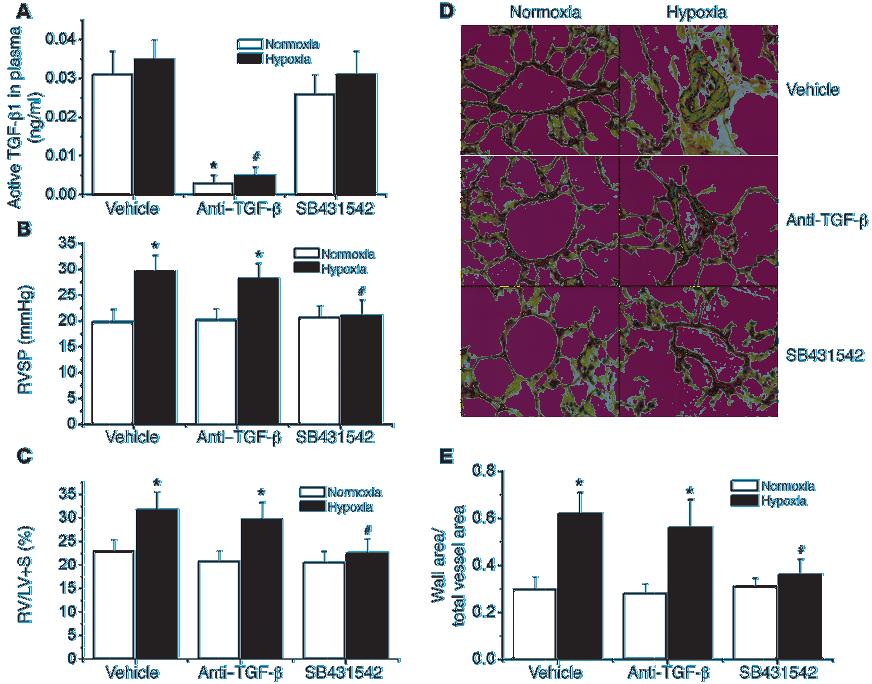 Figure 14 Effects of neutralizing anti TGF-β antibody and Alk5 inhibitor SB431542 on chronic hypoxia induced pulmonary hypertension and pulmonary vascular remodeling.