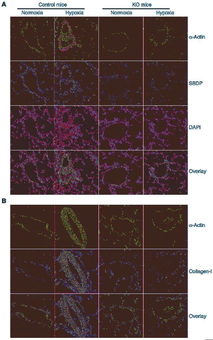 Figure 2 Effects of calpain inhibition by conditional knockout of calpain-4 on SBDP and collagen I in the smooth muscle of pulmonary arterioles of mice with hypoxic pulmonary hypertension.