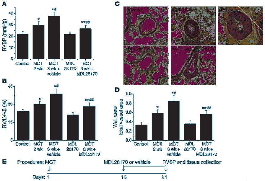 Figure 4 The specific calpain inhibitor MDL28170 prevents progression of MCT-induced pulmonary hypertension and pulmonary vascular remodeling in rats.
