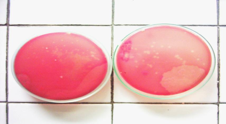 Padjadjaran Journal of Dentistry 2007, 18(1):13-19. Before After Figure 1. S. alpha colony from the plaque sample planted in blood agar before and after treatment Figure 2. The pattern of S.