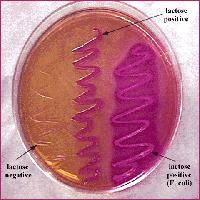 Identification of Enterobacteriaceae Differentiation between LF & NLF by Growth on MacConkey agar Method: MacConkey agar is inoculated with tested organism using streak plate technique Incubate the