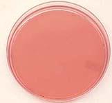 feremters Salmonella, Shigella, Proteus Pink colonies