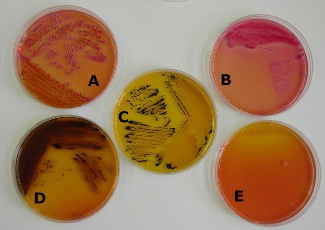 Growth of Enterobacteriaceae on SS agar A.Klebsiella pneumoniae B.Escherichia coli C :Salmonella sp.
