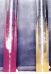 Urease Test Result If color of medium turns from yellow to pink indicates positive test.
