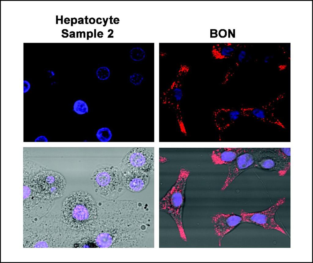 Freshly isolated hepatocytes do not express CgA Leja J et al.