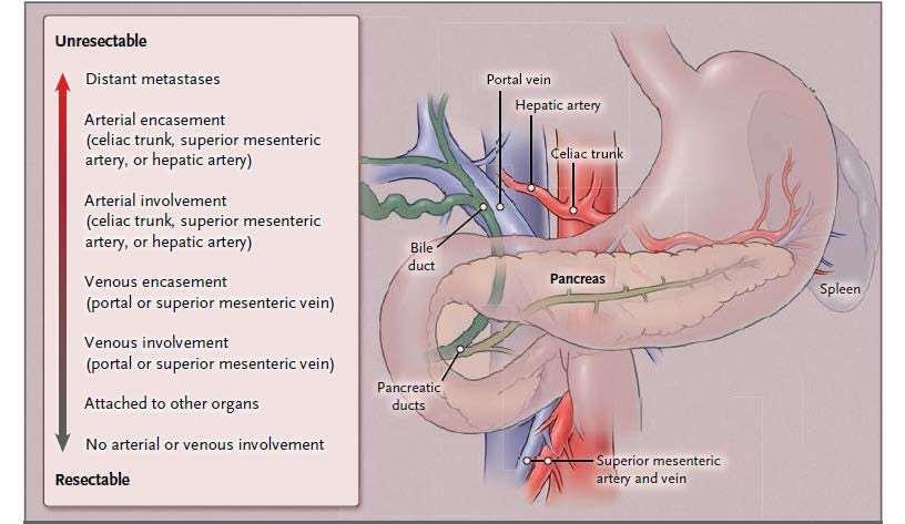 Anatomy of Pancreatic Cancer Ryan DP, et