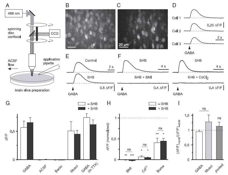 GABA Depolarizes Immature Neocortical Neurons in the Presence