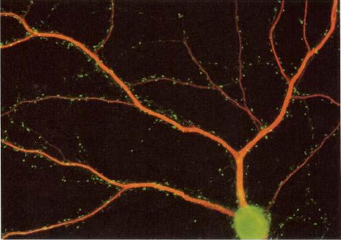 2.5: Cultured rat hippocampal neuron double labeled using