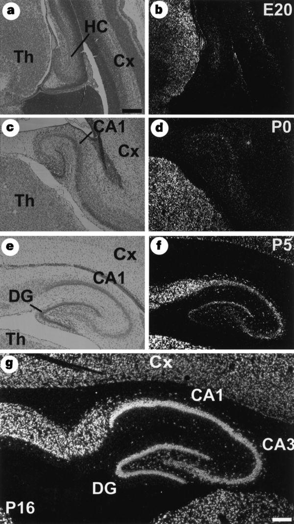 Expression of KCC2 mrna in the developing rat hippocampus
