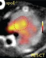 3) MRI Imaging Aortic Aneurysm Mouse Model and