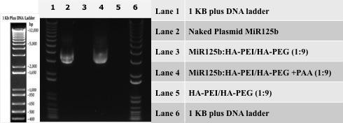 Supplementary Figure 2. Agarose gel electrophoresis analysis of plasmid encapsulation in HA-PEI/HA- PEG nanoparticles The gel showed that naked plasmid mir-125b-2 wasn t degraded in lane 2.