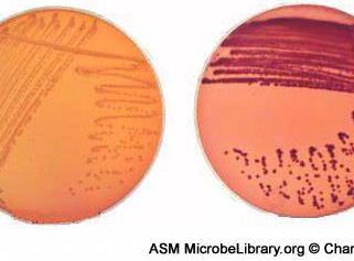 4Page Most bacteria ferment glucose but not lactose so we use lactose. *MaCconky agar selective &differentiate agar.