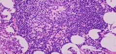 appearing lymphocytes Pale staining proliferation centers in lymph nodes,