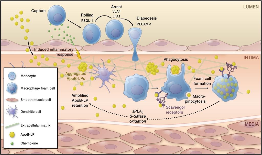Macrophages and Inflammation in the Artery