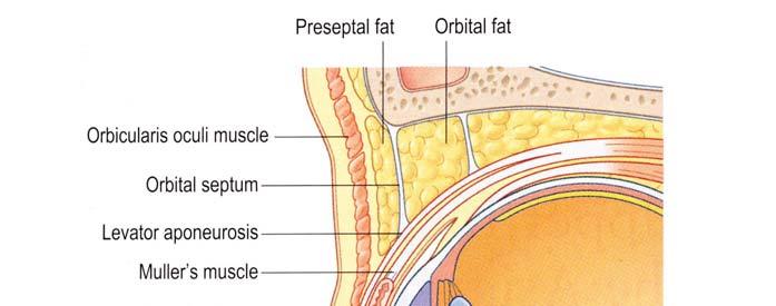 The orbital septum is a thin, whitish fibroelastic membrane.