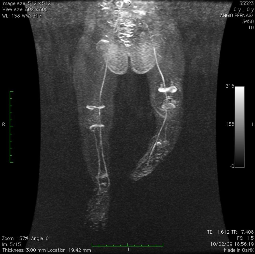 Fig. 9: Angio-MRI Fig.
