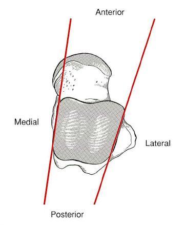 Subtalar joint (Talocalcaneal joint ) two separate parts divided by the tarsal canal lateral end : in front of the lateral malleolus canal runs posteromedially medial end : behind & above the
