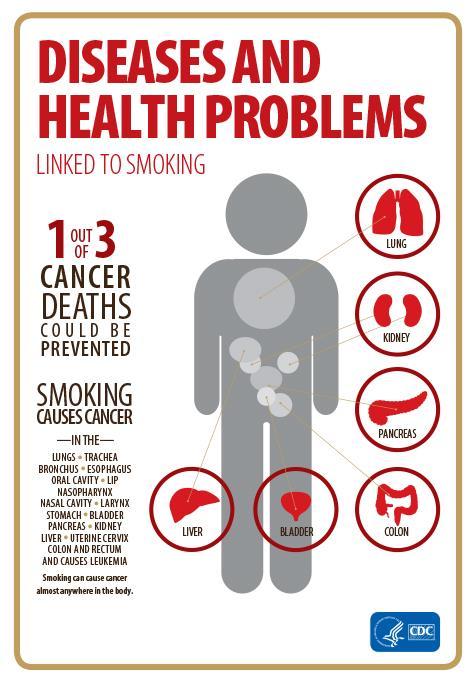 Smoking The Cancer Trigger Smoking is now known to cause 13 different types of