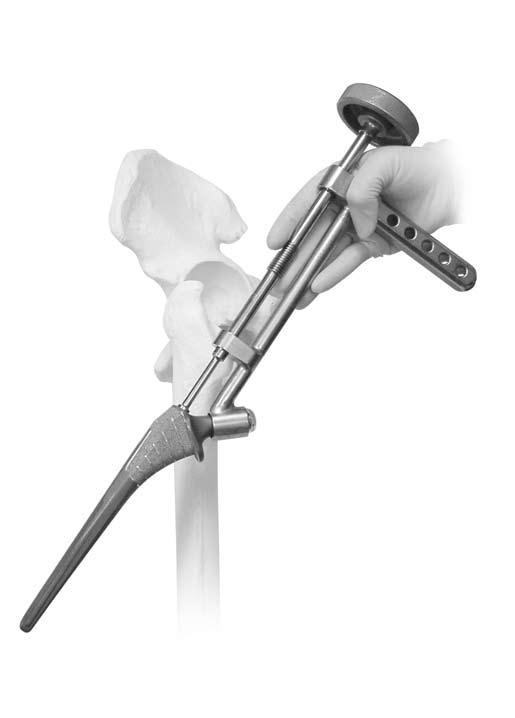 Natural-Hip System Surgical Technique 13 Femoral Implantation Instruments used: Natural-Hip Implant Holder Threaded Rod Non-threaded Rod Alignment Rod Universal Implant Slaphammer Tool Porous/HA