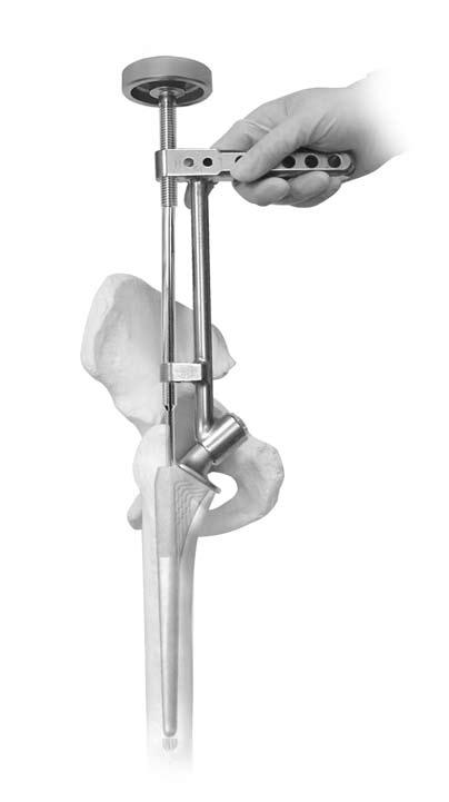 16 Natural-Hip System Surgical Technique Select the Natural-Hip size based on the final broach size used. Attach the stem to the Implant Holder (Fig. 23).