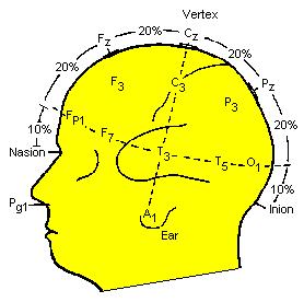 disorders Standard EEG High density