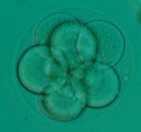 Therapeutic Cloning ES cells Nuclear transfer