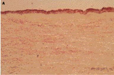 Microphotographs of oil red