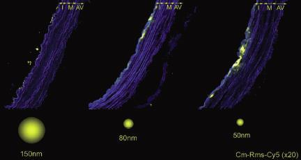 Image of arterial delivery and the effect of lipoprotein particle size Different isolates of chylomicron remnants of predetermined size were labeled with Cy5 fluorescence (in yellow).