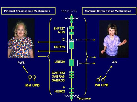 Figure 4: Angelman and Prader-Willi syndromes are caused by imprinting defects, parental disomy and large chromosome deletions in the 15q11-q13 chromosomal region. (Source: http://www.peds.ufl.