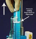 Zeroing the Pressure Transducer to Atmospheric Pressure Once the pressure