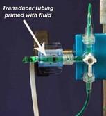 Prime the External Pressure Transducer* Prime the Transducer If using a pressure transducer, prime