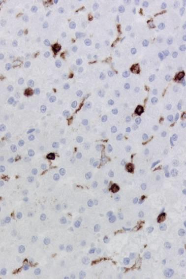 CD45 - Leucocyte common