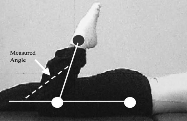 Figure 1- the measurement method of knee bending range of motion (The image extracted from Pealer and Anderson's article 2007) (1) The Measurement Method of Pain The amount of pain was evaluated by