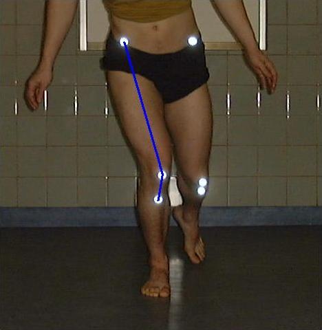 dimensional video data of the frontal plane movement of the knee were collected.