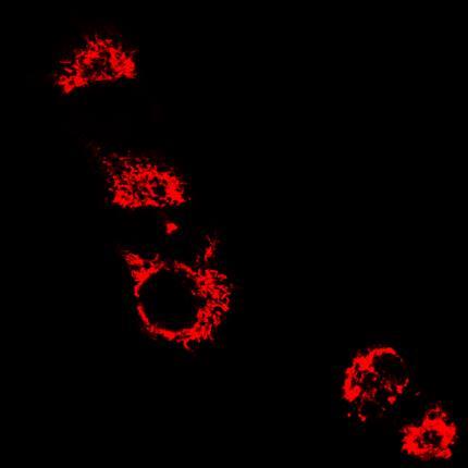 min and (B) oligomycin (5 ug/ml) treated HeLa cells stained with