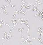 lentulus; in vitro assays Microscopic