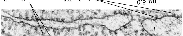 Actin filaments maintain the structure of a microvillus in the intestine; the base of the microvillus is anchored with intermediate filaments to the cell. Intermediate filaments dual fibrous subunit.