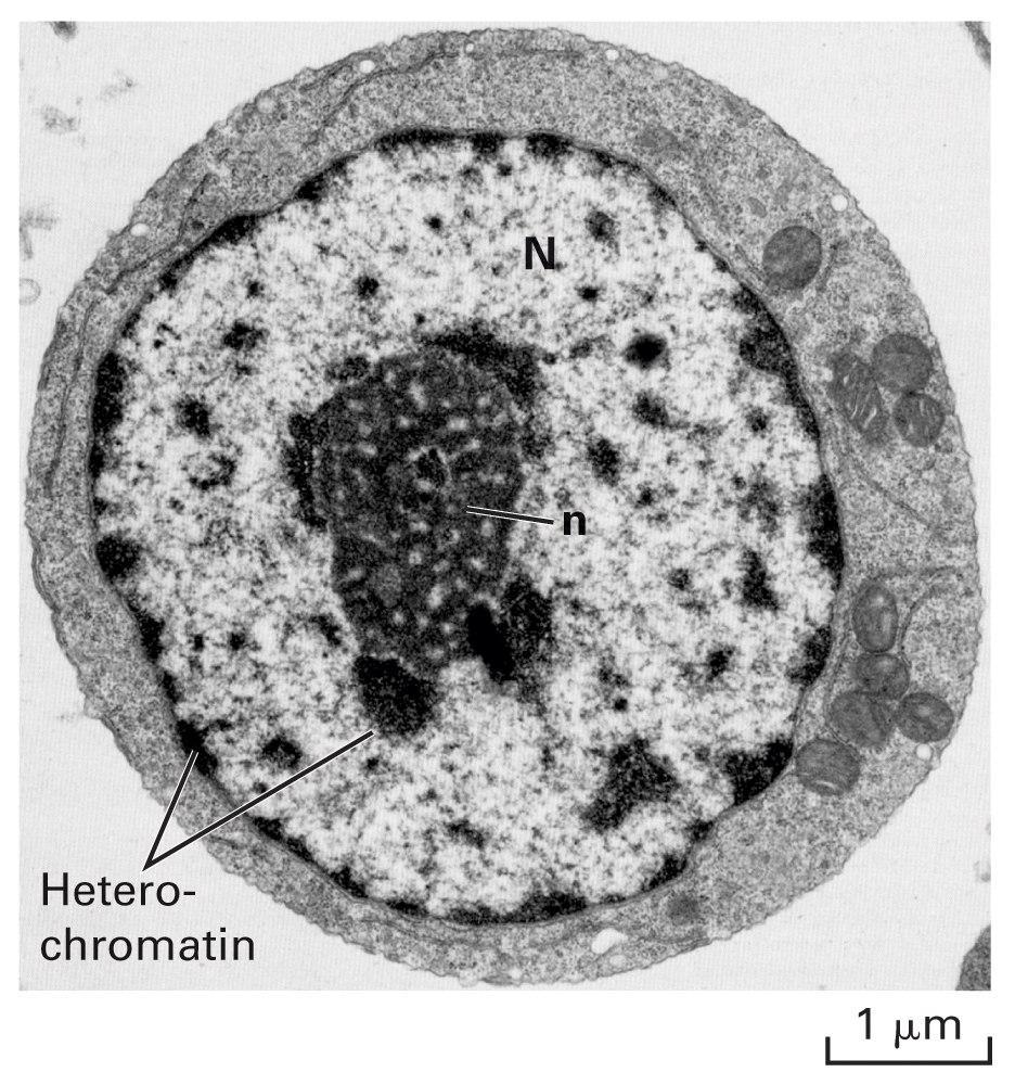Euchromatin and heterochromatin Euchromatin: less condensed chromatin, light color under microscope, actively transcribed genomic