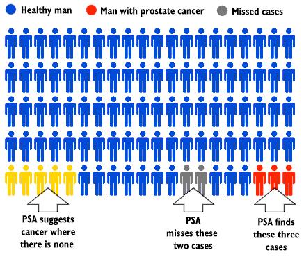 Prostate Specific Antigen (PSA) has a role