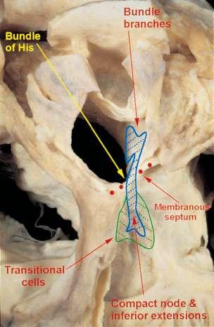 Atrio-Ventricular Node: Structure Transitional