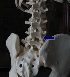 NECK AND LOW BACK (spine function) : The spine is a stack of bones (vertebrae) balanced upright. The spine must be MOBILE for movements and STABLE for posture.