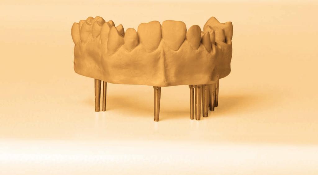 Elite Rock Type 4 extra hard dental die stone for fixed prosthesis A perfect balance between thixotropy and fluidity