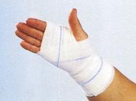Forearm, Wrist, and Hand Injuries Bandage a hand
