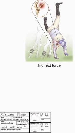 force Injury at point of impact
