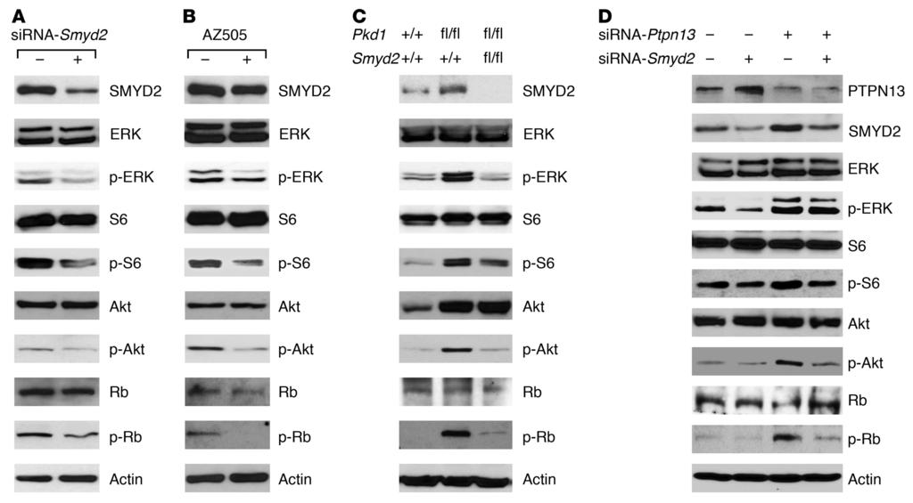 The Journal of Clinical Investigation RESEARCH ARTICLE Figure 7. PKD-associated signaling pathways could be affected by SMYD2 in Pkd1 mutant renal epithelial cells and cystic tissues.