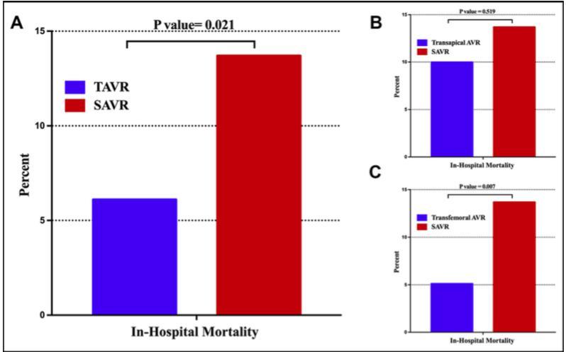 In-hospital Mortality in propensity-matched pts on maintenance ESRD