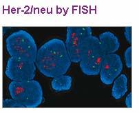 Trastuzumab (Herceptin): Humanized Anti-HER2 Antibody Targets HER2
