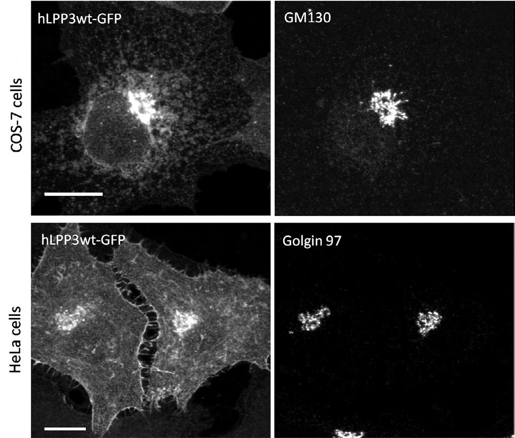 Fig. S1. Subcellular localization of overexpressed LPP3wt-GFP in COS-7 and HeLa cells.
