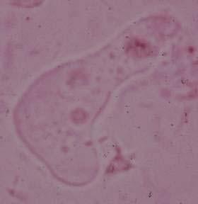 Excystation cyst wall disruption ameba emerges