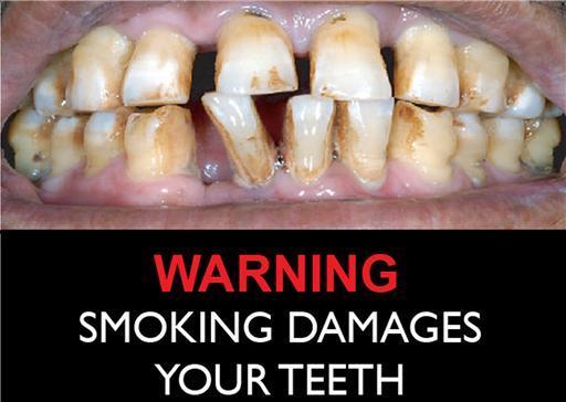 IMPACT ON TEETH, GUMS AND TONGUE Yellow and brown Diseased and require surgery